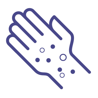 hand with hives icon